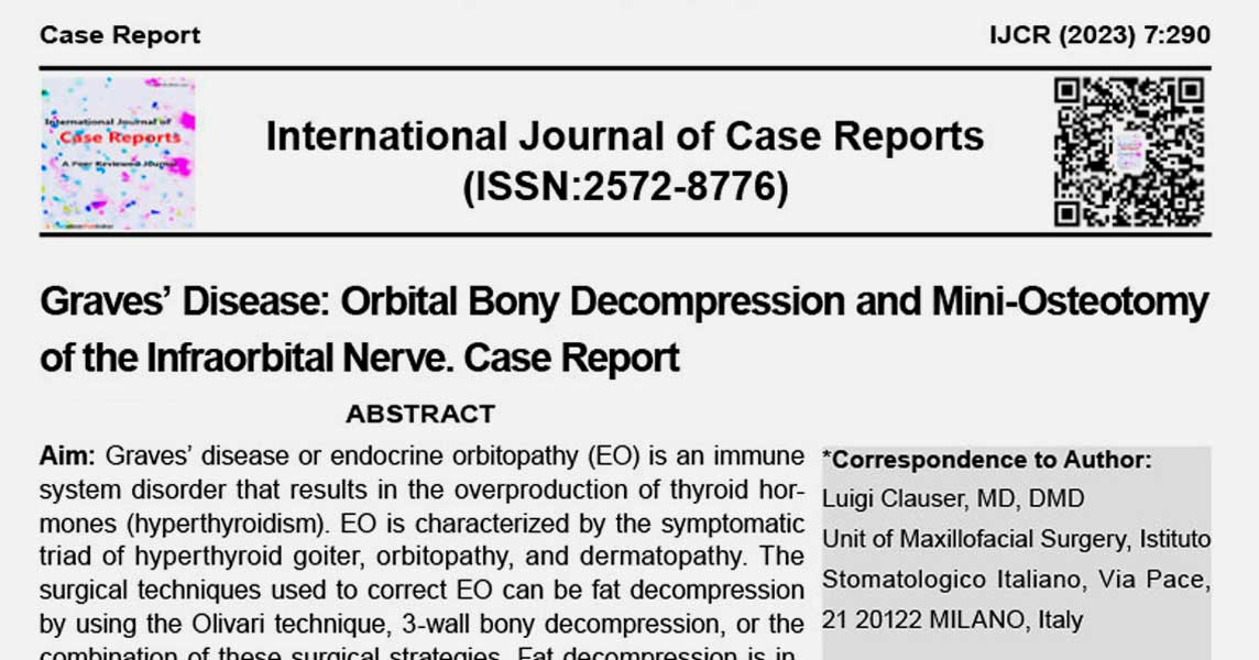 Article: Graves’ Disease: Orbital Bony Decompression ad Mini-Osteotomy of the Infraorbital Nerve. Case Report